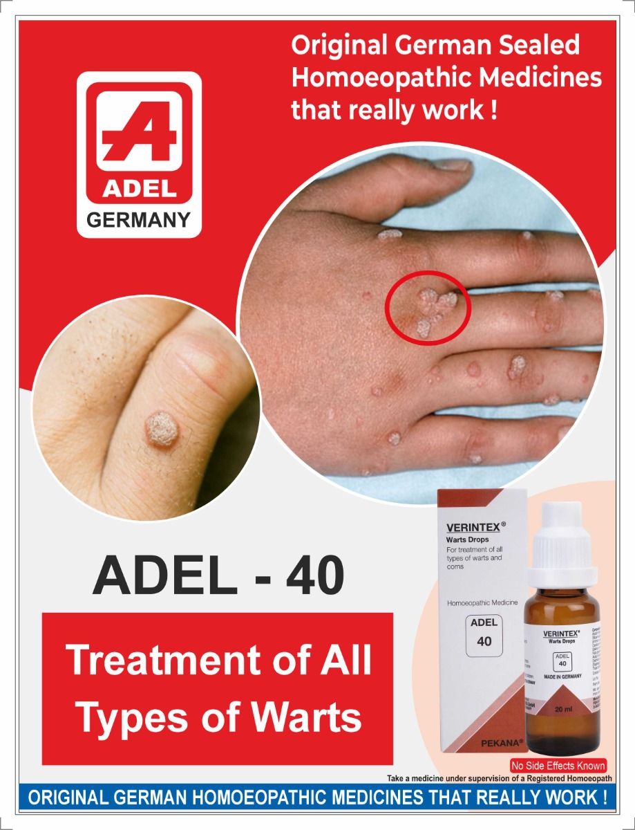 ADEL 40 Warts Drops