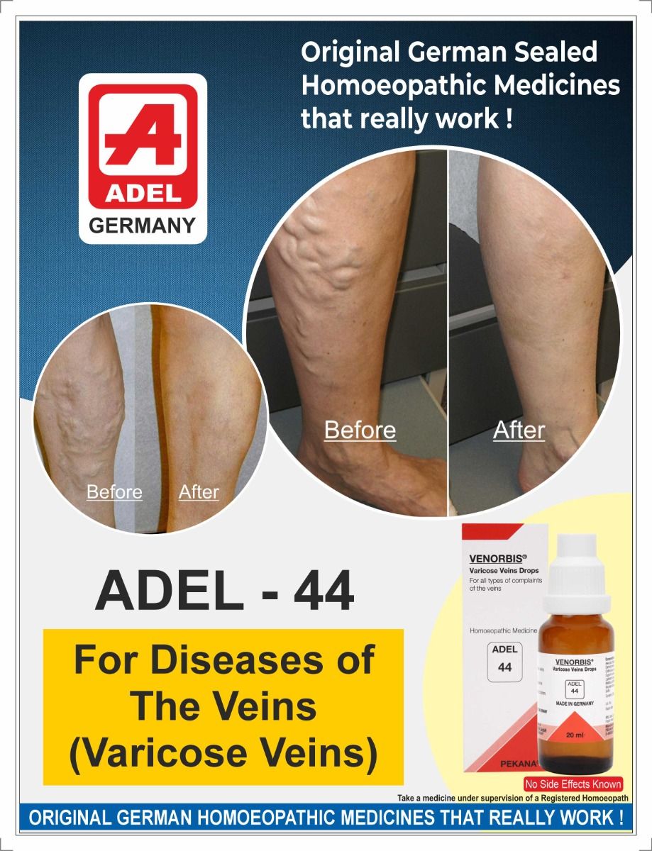 ADEL 44 Varicose Veins Drops