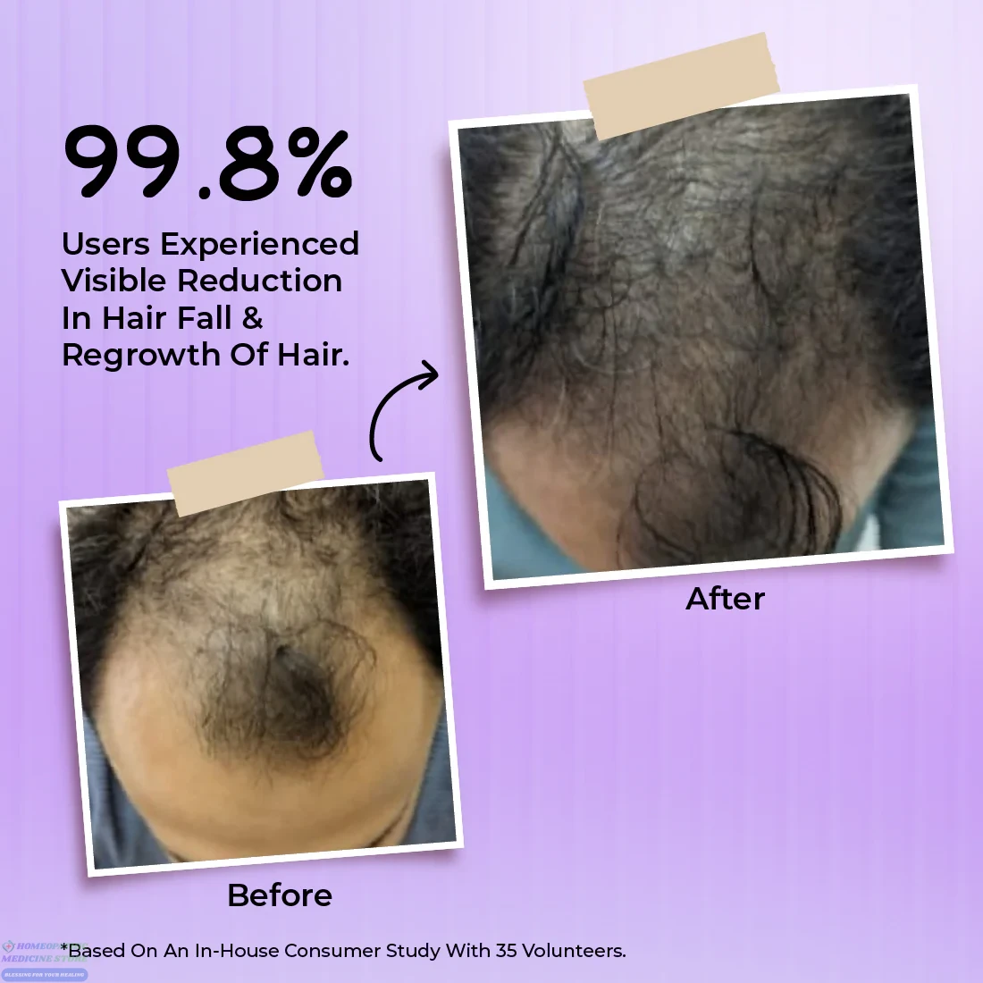 Bakson Hair Reviver Elixr